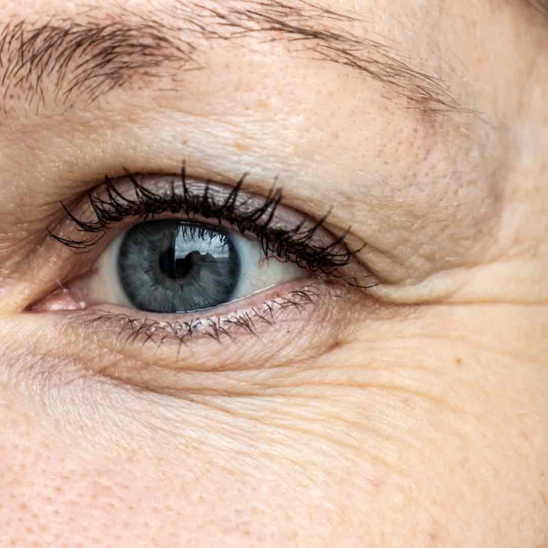 Close up of fine lines and wrinkles around a woman's eyes